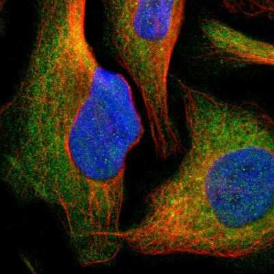 Immunocytochemistry/Immunofluorescence: Cytochrome P450 26B1 Antibody [NBP1-87371] - Immunofluorescent staining of human cell line U-2 OS shows localization to cytosol.