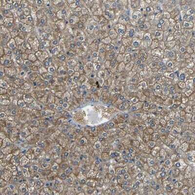 Immunohistochemistry-Paraffin: Cytochrome P450 26B1 Antibody [NBP1-87371] - Staining of human liver shows cytoplasmic and membranous positivity in hepatocytes.