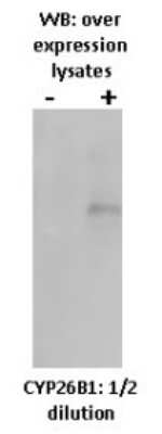 Western Blot: Cytochrome P450 26B1 Antibody (T5P3G2-A3) [NBP2-50195] - Detection of P450 26B1 in a overexpression lysate.