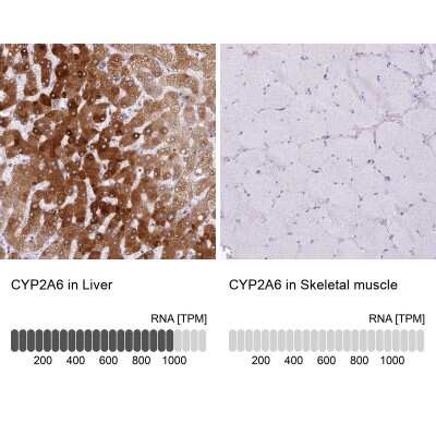 Immunohistochemistry-Paraffin: Cytochrome P450 2A6 Antibody [NBP2-33485] - Analysis in human liver and skeletal muscle tissues using NBP2-33485 antibody. Corresponding Cytochrome P450 2A6 RNA-seq data are presented for the same tissues.