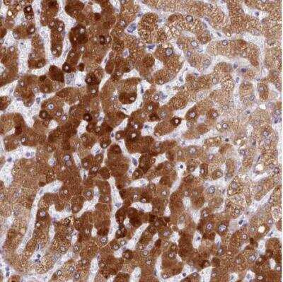 Immunohistochemistry-Paraffin: Cytochrome P450 2A6 Antibody [NBP2-33485] - Staining of human liver shows strong ctyoplasmic positivity in hepatocytes.