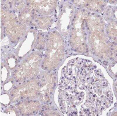 Immunohistochemistry-Paraffin: Cytochrome P450 2A6 Antibody [NBP2-33485] - Staining of human kidney shows ver weak cytoplasmic positivity in cells in tubules as expected.