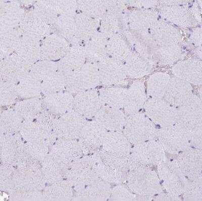 Immunohistochemistry-Paraffin: Cytochrome P450 2A6 Antibody [NBP2-33485] - Staining of human skeletal muscle shows no positivity in myocytes as expected.