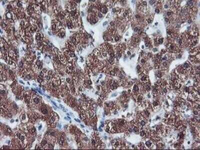 Immunohistochemistry: Cytochrome P450 2A6 Antibody (OTI1D2) - Azide and BSA Free [NBP2-70524] - Staining of paraffin-embedded Human liver tissue using anti-Cytochrome P450 2A6 mouse monoclonal antibody.