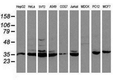 Western Blot: Cytochrome P450 2A6 Antibody (OTI1D2) - Azide and BSA Free [NBP2-70524] - Analysis of extracts (35ug) from 9 different cell lines by using anti-Cytochrome P450 2A6 monoclonal antibody (HepG2: human; HeLa: human; SVT2: mouse; A549: human; COS7: monkey; Jurkat: human; MDCK: canine; PC12: rat; MCF7: human).