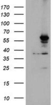 Western Blot: Cytochrome P450 2A6 Antibody (OTI1D2) - Azide and BSA Free [NBP2-70524] - HEK293T cells were transfected with the pCMV6-ENTRY control (Left lane) or pCMV6-ENTRY Cytochrome P450 2A6 (Right lane) cDNA for 48 hrs and lysed. Equivalent amounts of cell lysates (5 ug per lane) were separated by SDS-PAGE and immunoblotted with anti-Cy