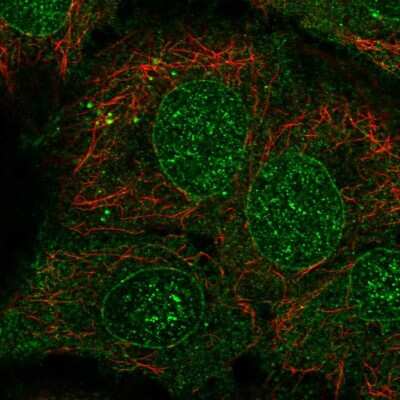 Immunocytochemistry/Immunofluorescence: Cytochrome P450 2B6 Antibody [NBP2-57140] - Staining of human cell line HaCaT shows localization to nuclear membrane & cytosol.