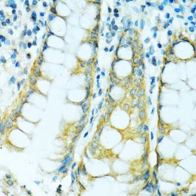 Immunohistochemistry-Paraffin: Cytochrome P450 2B6 Antibody [NBP2-92746] - Paraffin-embedded human colon using Cytochrome P450 2B6 .