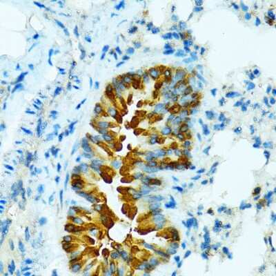 Immunohistochemistry-Paraffin: Cytochrome P450 2B6 Antibody [NBP2-92746] - Paraffin-embedded mouse lung using Cytochrome P450 2B6 .