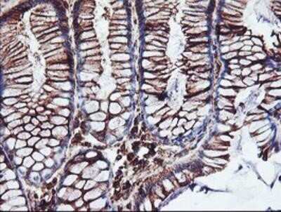 Immunohistochemistry: Cytochrome P450 2B6 Antibody (OTI3D5) - Azide and BSA Free [NBP2-70526] - Staining of paraffin-embedded Human colon tissue using anti-Cytochrome P450 2B6 mouse monoclonal antibody.