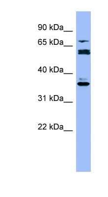 Western Blot: Cytochrome P450 2B6 Antibody [NBP1-57978] - THP-1 cell lysate, concentration 0.2-1 ug/ml.