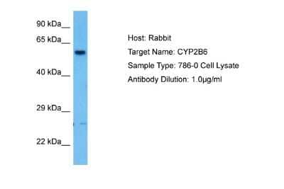 Western Blot: Cytochrome P450 2B6 Antibody [NBP2-87242] - Host: Rabbit. Target Name: CYP2B6. Sample Tissue: Human 786-0 Whole Cell lysates. Antibody Dilution: 1ug/ml