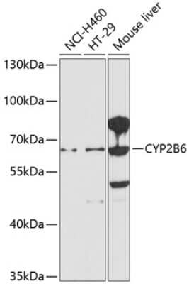 Western Blot: Cytochrome P450 2B6 Antibody [NBP2-92746] - Analysis of extracts of various cell lines, using Cytochrome P450 2B6 .Exposure time: 90s.