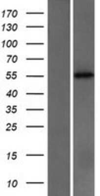 Western Blot: Cytochrome P450 2C18 Overexpression Lysate (Adult Normal) [NBP2-10705] Left-Empty vector transfected control cell lysate (HEK293 cell lysate); Right -Over-expression Lysate for Cytochrome P450 2C18.