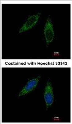 Immunocytochemistry/Immunofluorescence: Cytochrome P450 2C8 Antibody [NBP2-16078] - Analysis of methanol-fixed HeLa, using antibody at 1:500 dilution.