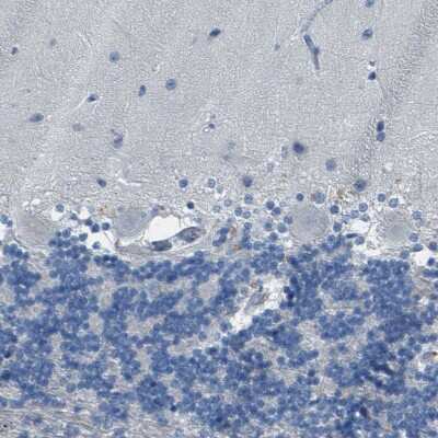 Immunohistochemistry-Paraffin: Cytochrome P450 2C8 Antibody [NBP1-88055] - Staining of human cerebellum shows no positivity in Purkinje cells as expected.