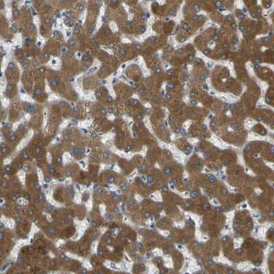 Immunohistochemistry-Paraffin: Cytochrome P450 2C8 Antibody [NBP1-88055] - Staining of human liver shows strong cytoplasmic positivity in hepatocytes.