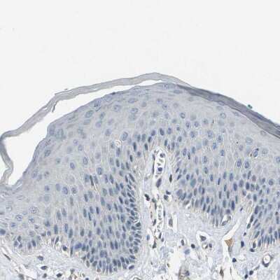 Immunohistochemistry-Paraffin: Cytochrome P450 2C8 Antibody [NBP1-88055] - Staining of human skin shows no positivity in squamous epithelial cells as expected.