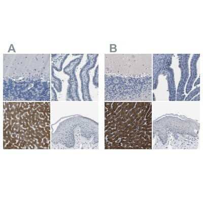 <b>Independent Antibodies Validation. </b>Immunohistochemistry-Paraffin: Cytochrome P450 2C8 Antibody [NBP1-88055] - Staining of human cerebellum, fallopian tube, liver and skin using Anti-CYP2C8 antibody (A) NBP1-88055 shows similar protein distribution across tissues to independent antibody NBP1-88054 (B).