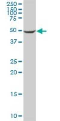 Western Blot: Cytochrome P450 2C8 Antibody [H00001558-B01P] - Analysis of CYP2C8 expression in human liver.