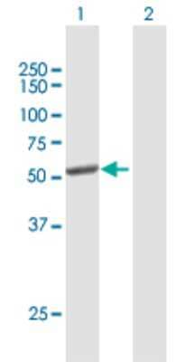 Western Blot: Cytochrome P450 2C8 Antibody [H00001558-B01P] - Analysis of CYP2C8 expression in transfected 293T cell line by CYP2C8 polyclonal antibody.  Lane 1: CYP2C8 transfected lysate(53.9 KDa). Lane 2: Non-transfected lysate.