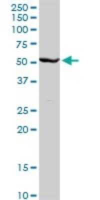 Western Blot: Cytochrome P450 2C8 Antibody [H00001558-D01P] - Analysis of CYP2C8 expression in human liver.