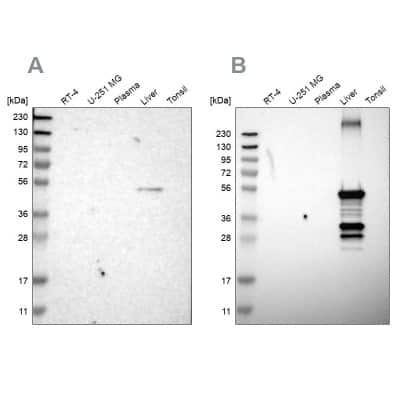 Western Blot: Cytochrome P450 2C8 Antibody [NBP1-88055] - Analysis using Anti-CYP2C8 antibody NBP1-88055 (A) shows similar pattern to independent antibody NBP1-88054 (B).