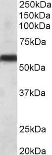 Western Blot: Cytochrome P450 2C8 Antibody [NBP1-97759] - (0.1ug/ml) staining of Human Liver lysate (35ug protein in RIPA buffer). Primary incubation was 1 hour. Detected by chemiluminescence.