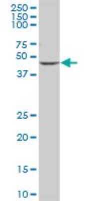 Western Blot: Cytochrome P450 2D6 Antibody [H00001565-B01P] - Analysis of CYP2D6 expression in human liver.