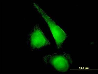 Immunocytochemistry/Immunofluorescence: Cytochrome P450 2E1 Antibody [H00001571-B01P] - Analysis of purified antibody to CYP2E1 on HeLa cell. (antibody concentration 10 ug/ml)