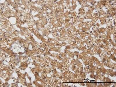 Immunohistochemistry-Paraffin: Cytochrome P450 2E1 Antibody [H00001571-B01P] - Analysis of purified antibody to CYP2E1 on formalin-fixed paraffin-embedded human liver. (antibody concentration 3 ug/ml)