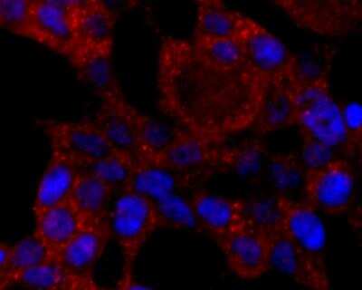Immunocytochemistry/Immunofluorescence: Cytochrome P450 2E1 Antibody (JM10-85) [NBP2-67021] - The nuclear counter stain is DAPI (blue). Cells were fixed in paraformaldehyde, permeabilised with 0.25% Triton X100/PBS.