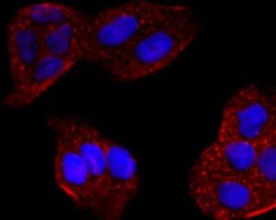 Immunocytochemistry/Immunofluorescence: Cytochrome P450 2E1 Antibody (JM10-85) [NBP2-67021] - The nuclear counter stain is DAPI (blue). Cells were fixed in paraformaldehyde, permeabilised with 0.25% Triton X100/PBS.