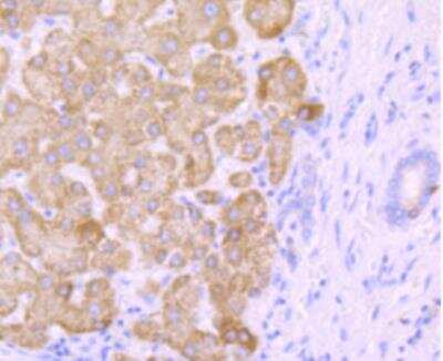 Immunohistochemistry-Paraffin: Cytochrome P450 2E1 Antibody (JM10-85) [NBP2-67021] - Analysis of paraffin-embedded human liver tissue using anti-CYP2E1 antibody. Counter stained with hematoxylin.