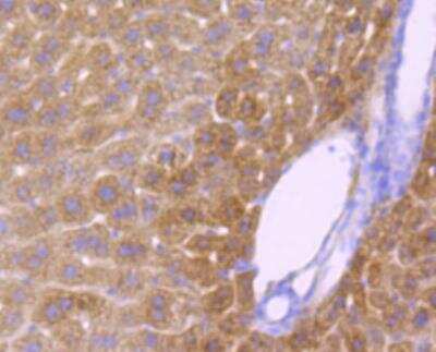 Immunohistochemistry-Paraffin: Cytochrome P450 2E1 Antibody (JM10-85) [NBP2-67021] - Analysis of paraffin-embedded mouse liver tissue using anti-CYP2E1 antibody. Counter stained with hematoxylin.