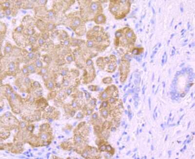 Immunohistochemistry-Paraffin: Cytochrome P450 2E1 Antibody (JM10-85) [NBP2-67021] - Analysis of paraffin-embedded human liver tissue using anti-CYP2E1 antibody. Counter stained with hematoxylin.