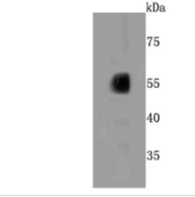 Western Blot: Cytochrome P450 2E1 Antibody (JM10-85) [NBP2-67021] - Analysis of CYP2E1 on human liver cells lysates using anti-CYP2E1 antibody at 1/500 dilution.