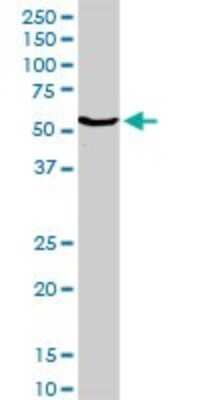 Western Blot: Cytochrome P450 2E1 Antibody [H00001571-D01P] - Analysis of CYP2E1 expression in human colon.