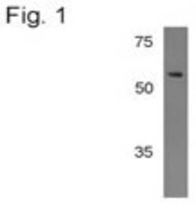 Western Blot: Cytochrome P450 3A4/3A5 Antibody (F24 P2 B10) [NB100-74400] - Bovine liver samples