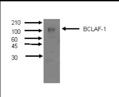 Western Blot: Cytochrome P450 3A4, 3A5 Antibody (F24P2B10) [NBP2-50208] - Western Blot of recombinant CYP450s