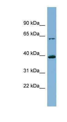 Western Blot: Cytochrome P450 3A4/3A5 Antibody [NBP1-62672] - THP-1 cell lysate, concentration 0.2-1 ug/ml.