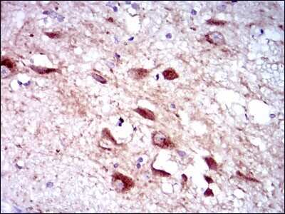 Immunohistochemistry-Paraffin: Cytochrome P450 3A4 Antibody (3H8) [NBP2-37502] - Analysis of  human brain tissues using CYP3A4 mouse mAb with DAB staining.