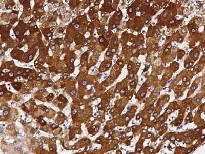 Immunohistochemistry-Paraffin: Cytochrome P450 3A4 Antibody [NBP2-99089] - Staining of human Cytochrome P450 3A4 in human liver with rabbit polyclonal antibody (1:1000). 