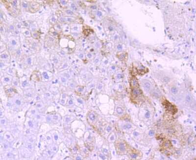 Immunohistochemistry-Paraffin: Cytochrome P450 3A4 Antibody (JA11-33) [NBP2-67022] - Analysis of paraffin-embedded human liver tissue using anti-Cytochrome P450 3A4 antibody. Counter stained with hematoxylin.