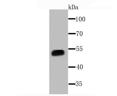 Western Blot: Cytochrome P450 3A4 Antibody (JA11-33) [NBP2-67022] - Analysis of Cytochrome P450 3A4 on human liver tissue lysate using anti-Cytochrome P450 3A4 antibody at 1/1,000 dilution.
