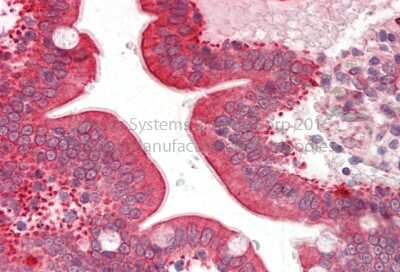 Immunohistochemistry: Cytochrome P450 3A5 Antibody [NBP1-68885] - Human Adult Small intestine Observed Staining: Cytoplasm in hepatocytes Primary Antibody Concentration: 1 : 600 Secondary Antibody: Donkey anti-Rabbit-Cy3 Secondary Antibody Concentration: 1 : 200 Magnification: 20X Exposure Time: 0.5 2.0 sec.