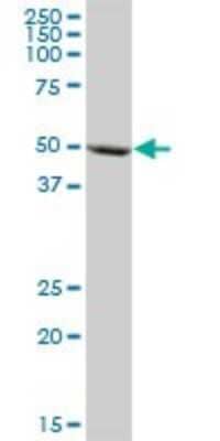 Western Blot: Cytochrome P450 3A5 Antibody [H00001577-B01P] - Analysis of CYP3A5 expression in human liver.