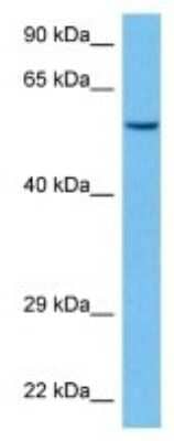 Western Blot: Cytochrome P450 3A5 Antibody [NBP3-10842] - Western blot analysis of Cytochrome P450 3A5 in Mouse Pancreas lysates. Antibody dilution at 1ug/ml