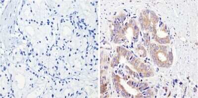 Immunohistochemistry-Paraffin: Cytochrome P450 3A7 Antibody (F19 P2 H2) [NB100-74402] - Analysis showing positive staining in the cytoplasm of Human prostate carcinoma (right) compared with a negative control in the absence of primary antibody (left).