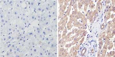 Immunohistochemistry-Paraffin: Cytochrome P450 3A7 Antibody (F19 P2 H2) [NB100-74402] - Analysis showing positive staining in the cytoplasm of Human liver tissue (right) compared with a negative control in the absence of primary antibody (left).